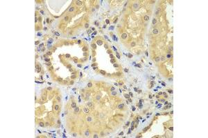 Immunohistochemistry of paraffin-embedded human kidney using CIAO1 antibody (ABIN5975509) at dilution of 1/100 (40x lens). (CIAO1 antibody)