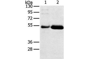 Western Blot analysis of Human placenta and stomach cancer tissue using SAMD3 Polyclonal Antibody at dilution of 1:400 (SAMD3 antibody)