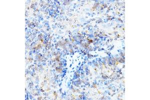 Immunohistochemistry of paraffin-embedded mouse spleen using ULBP1 Rabbit pAb (ABIN6128898, ABIN6149917, ABIN6149918 and ABIN6214755) at dilution of 1:500 (40x lens). (ULBP1 antibody  (AA 26-216))