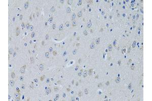 Immunohistochemistry of paraffin-embedded mouse brain using FDFT1 antibody (ABIN5973667) at dilution of 1/100 (40x lens). (FDFT1 antibody)