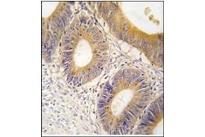 Image no. 2 for anti-Aldolase C, Fructose-Bisphosphate (ALDOC) (C-Term) antibody (ABIN357882) (ALDOC antibody  (C-Term))