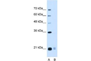 WB Suggested Anti-PLAC1L Antibody Titration:  0. (PLAC1L antibody  (Middle Region))