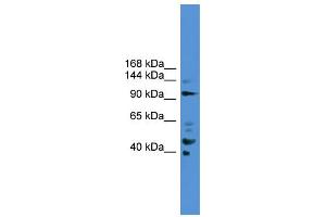 WB Suggested Anti-PIBF1  Antibody Titration: 0. (PIBF1 antibody  (C-Term))