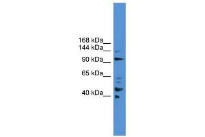 WB Suggested Anti-PIBF1  Antibody Titration: 0.