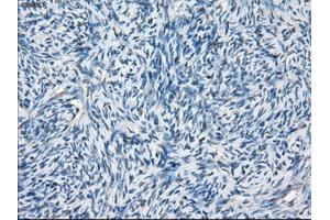 Immunohistochemical staining of paraffin-embedded Ovary tissue using anti-BCKDK mouse monoclonal antibody. (BCKDK antibody)