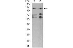 Western blot analysis using SMARCA1 mouse mAb against SW620 (1) and HT-29 (2) cell lysate.