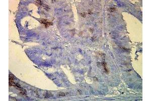 Immunohistochemistry analysis using Mouse Anti-Hsp70 Monoclonal Antibody, Clone BB70 . (HSP70/HSC70 antibody  (PE))