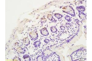 Formalin-fixed and paraffin embedded rat intestine labeled with Anti CCR10 Polyclonal Antibody, Unconjugated  at 1:200 followed by conjugation to the secondary antibody and DAB staining (CCR10 antibody  (AA 1-52))