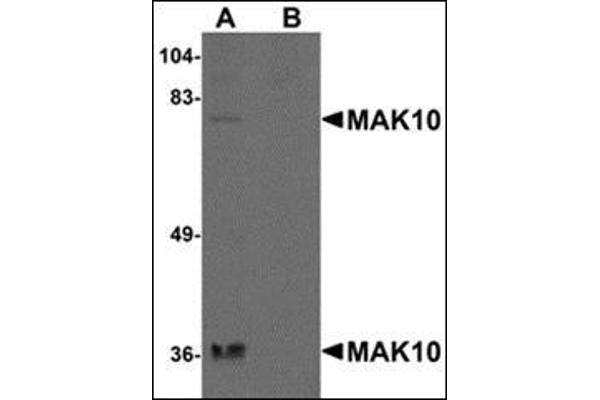 MAK10/NAA35 antibody  (N-Term)