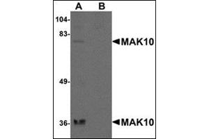 Western blot analysis of MAK10 in rat heart tissue lysate with this product at 1 μg/ml in the (A) absence and (B) presence of blocking peptide. (MAK10/NAA35 antibody  (N-Term))