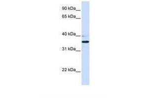 Image no. 1 for anti-UDP-Gal:betaGlcNAc beta 1,3-Galactosyltransferase, Polypeptide 1 (B3GALT1) (N-Term) antibody (ABIN6738584) (B3GALT1 antibody  (N-Term))