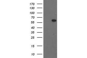 HEK293T cells were transfected with the pCMV6-ENTRY control (Left lane) or pCMV6-ENTRY BAIAP2 (Right lane) cDNA for 48 hrs and lysed. (BAIAP2 antibody)