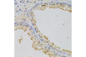 Immunohistochemistry of paraffin-embedded human prostate using ALB antibody. (Albumin antibody)