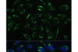 Immunofluorescence analysis of U-2 OS cells using HSD17B10 Polyclonal Antibody at dilution of 1:100 (40x lens). (HSD17B10 antibody)