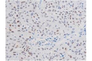 Immunohistochemistry (IHC) image for anti-Signal Transducer and Activator of Transcription 1, 91kDa (STAT1) (pSer727) antibody (ABIN6256410)