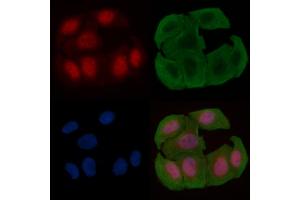 ABIN6255330 and ABIN6277725 staining Hela cells(30 min of UV treatment) by IF/ICC. (ATR antibody  (pSer428))