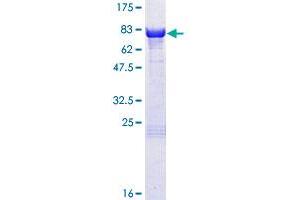 Image no. 1 for Protein Kinase, CAMP-Dependent, Regulatory, Type I, beta (PRKAR1B) (AA 1-381) protein (GST tag) (ABIN1316245) (PRKAR1B Protein (AA 1-381) (GST tag))