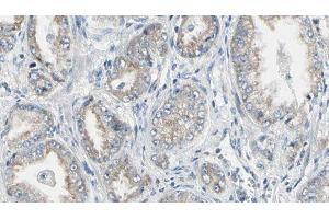 ABIN6276723 at 1/100 staining Human prostate tissue by IHC-P. (NAT1 antibody  (Internal Region))