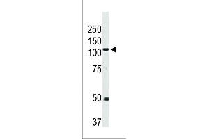Western blot analysis of anti-BMPR2 Pab in mouse heart tissue lysate (BMPR2 antibody  (N-Term))