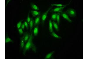 Immunofluorescence staining of Hela cells with ABIN7161246 at 1:166, counter-stained with DAPI. (AHNAK antibody  (AA 5689-5801))
