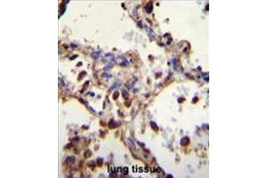 WDR52 Antibody (C-term) immunohistochemistry analysis in formalin fixed and paraffin embedded human lung tissue followed by peroxidase conjugation of the secondary antibody and DAB staining. (WDR52 antibody  (C-Term))