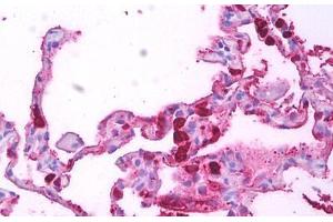 Anti-Macrophages antibody IHC staining of human lung, macrophages. (Macrophages antibody)