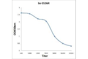 Antigen: 0. (TRAK1 antibody  (AA 171-270))