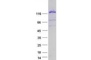 Validation with Western Blot (USP8 Protein (Transcript Variant 2) (Myc-DYKDDDDK Tag))