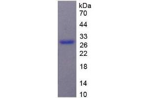 SDS-PAGE (SDS) image for Melanoma Associated Chondroitin Sulfate Proteoglycan (MCSP) (AA 1705-1942) protein (His tag) (ABIN1170940)