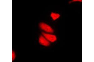 Immunofluorescent analysis of MDA5 staining in THP1 cells. (IFIH1 antibody  (C-Term))