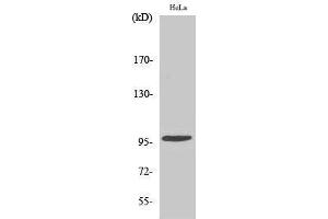 Western Blotting (WB) image for anti-Checkpoint Kinase 2 (CHEK2) (pThr68) antibody (ABIN3179414) (CHEK2 antibody  (pThr68))