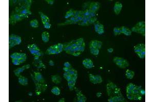 Image no. 9 for anti-ATP Synthase, H+ Transporting, Mitochondrial F1 Complex, beta Polypeptide (ATP5B) antibody (ABIN1496769) (ATP5B antibody)