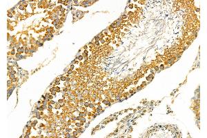ABIN6266241 and ABIN6277393 at 1/100 staining Rat testis tissue by IHC-P. (Kallikrein 2 antibody  (Internal Region))
