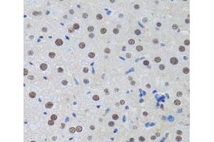 Immunohistochemistry of paraffin-embedded Rat liver using MTA3 Polyclonal Antibody at dilution of 1:100 (40x lens).
