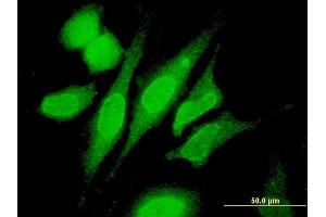 Immunofluorescence of monoclonal antibody to RNF180 on HeLa cell. (RNF180 antibody  (AA 1-100))