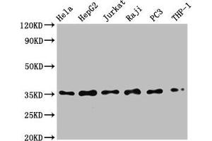 Western Blot Positive WB detected in: Hela whole cell lysate, HepG2 whole cell lysate, Jurkat whole cell lysate, Raji whole cell lysate, PC3 whole cell lysate, THP-1 whole cell lysate All lanes: NFKBIA antibody at 0. (Recombinant NFKBIA antibody)