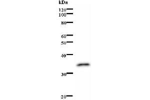 Western Blotting (WB) image for anti-Thyroid Hormone Receptor, alpha (THRA) antibody (ABIN931176) (THRA antibody)