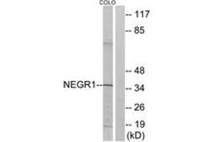 Western blot analysis of extracts from COLO cells, using NEGR1 Antibody. (NEGR1 antibody  (AA 172-221))