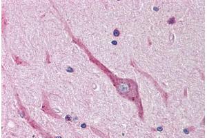 Human Brain, Cerebellum (formalin-fixed, paraffin-embedded) stained with SNAI2 antibody ABIN214479 at 2. (SLUG antibody  (Internal Region))