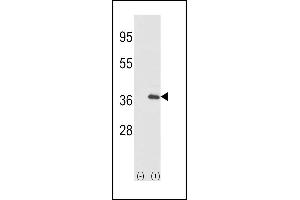 Western blot analysis of IL1A (arrow) using rabbit polyclonal IL1A-pS87 (ABIN390844 and ABIN2841070). (IL1A antibody  (AA 65-94))