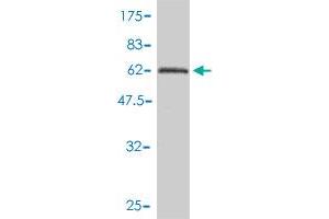 Western Blot detection against Immunogen (61. (PPP1CC antibody  (AA 1-323))