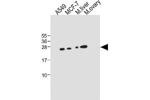 All lanes : Anti-PEMT Antibody (C-term) at 1:1000 dilution Lane 1: A549 whole cell lysate Lane 2: MCF-7 whole cell lysate Lane 3: Mouse liver tissue lysate Lane 4: Mouse ovary tissue lysate Lysates/proteins at 20 μg per lane. (PEMT antibody  (C-Term))