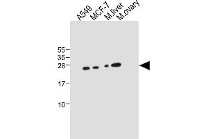 PEMT antibody  (C-Term)