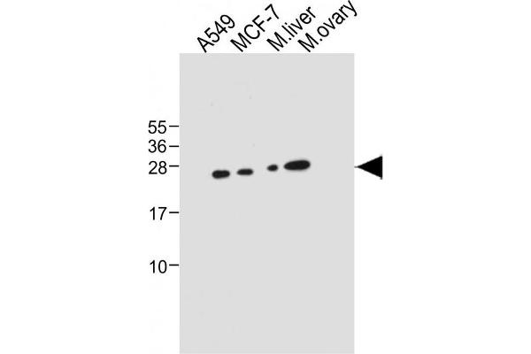 PEMT anticorps  (C-Term)