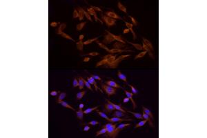 Immunofluorescence analysis of PC-12 cells using PI3 Kinase p85 alpha Rabbit pAb (ABIN6130616, ABIN6145641, ABIN6145644 and ABIN6215094) at dilution of 1:100 (40x lens). (PIK3R1 antibody)