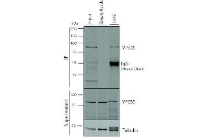 Immunoprecipitation analysis using Mouse Anti-VPS35 Monoclonal Antibody, Clone 10A8 (ABIN6932998).