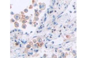 Figure. (TCN2 antibody  (AA 19-427))