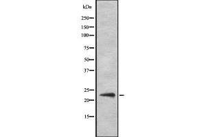 Western blot analysis of SOCS2 Antibody expression in Hela cells lysates. (SOCS2 antibody)
