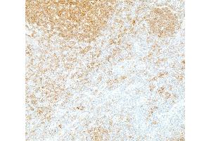 Immunohistochemistry (IHC) image for anti-REL proto-oncogene (c-Rel) (C-Term) antibody (ABIN7795771) (Recombinant c-Rel antibody  (C-Term))