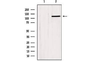 Western blot analysis of extracts from Hela, using SLC24A1 Antibody. (SLC24A1 antibody  (N-Term))